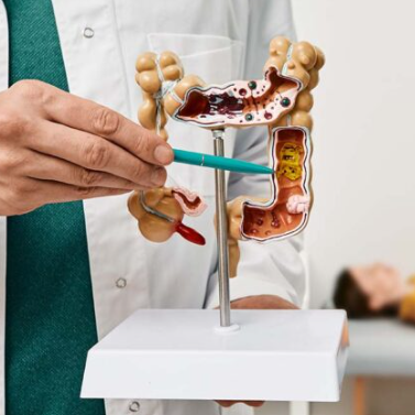 Νόσος Crohn